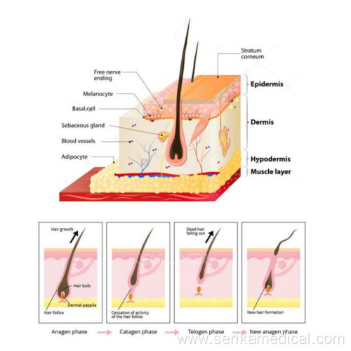 Vertical 808nm Hair Removal Machine